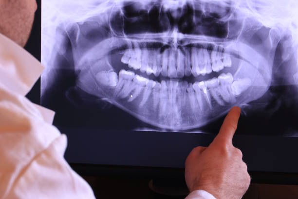 Best Urgent Care for Lost Fillings or Crowns in Arta, CA